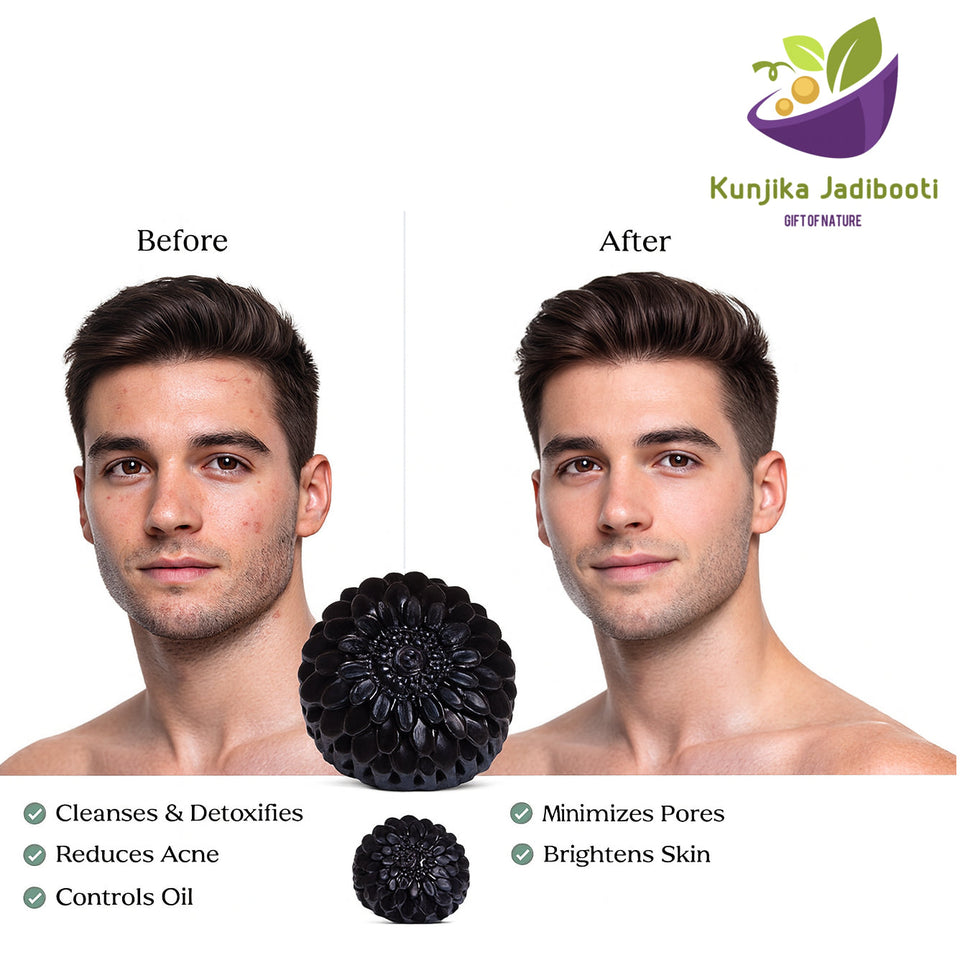 Kunjika Jadibooti Activated Charcoal Soap Black Detox for Face & Body | Deep Cleansing, Oil Control & Acne Care | Handmade Natural Bath Bar with Aloe Vera, Vitamin E and Tea tree Essential oil